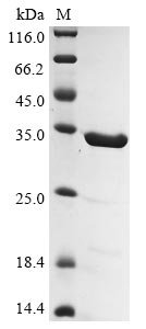 Recombinant Human Gelsolin (GSN), partial, Homo sapiens (Human), E.coli, N-terminal 6xHis-tagged, 33.5kDa, purity >90% as determined by SDS-PAGE.