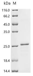 Recombinant Rat Claudin-1 (Cldn1) Protein, Rattus norvegicus (Rat), in vitro E.coli expression system, N-terminal 10xHis-tagged, 28.9kDa, purity >85% as determined by SDS-PAGE.