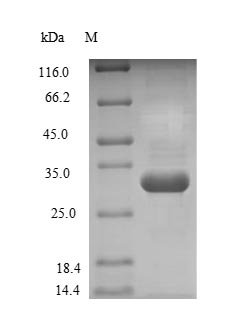 Recombinant Human Glutathione S-transferase P (GSTP1), Homo sapiens (Human), E.coli, N-terminal 6xHis-tagged, 27.2kDa, purity >90% as determined by SDS-PAGE.