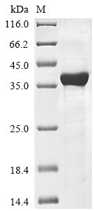 Recombinant Human Hyaluronan and proteoglycan link protein 2 (HAPLN2), Homo sapiens (Human), E.coli, N-terminal 10xHis-tagged, 40.8kDa, purity >85% as determined by SDS-PAGE.