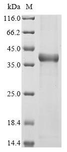 Recombinant Human Protein deacetylase HDAC6 (HDAC6), partial