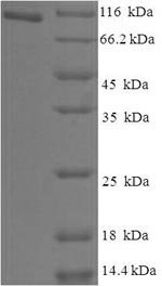 Recombinant Human Holliday junction recognition protein (HJURP)