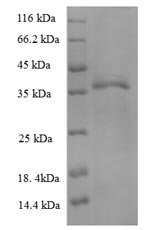 Recombinant Human HLA-B protein (HLA-B), partial
