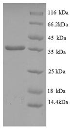 Recombinant Human HLA class I histocompatibility antigen, C alpha chain (HLA-C), partial