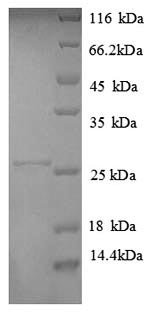 Recombinant Human HLA class II histocompatibility antigen, DP alpha 1 chain (HLA-DPA1), partial, Homo sapiens (Human), E.coli, N-terminal 6xHis-tagged, 26.3kDa, purity >90% as determined by SDS-PAGE.