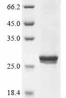 (Tris-Glycine gel) Discontinuous SDS-PAGE (reduced) with 5% enrichment gel and 15% separation gel.
