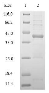 Recombinant Human HLA class II histocompatibility antigen, DRB1 beta chain (HLA-DRB1), partial, Homo sapiens (Human), E.coli, N-terminal 10xHis-SUMO-tagged and C-terminal Myc-tagged, 42.9kDa, purity >90% as determined by SDS-PAGE.