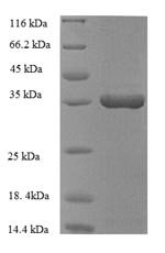 Recombinant Human Heme oxygenase 1 (HMOX1), partial