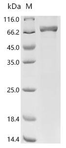 Recombinant Human Hepatocyte nuclear factor 4-alpha (HNF4A)