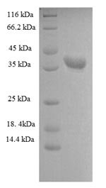 Recombinant Human Heterogeneous nuclear ribonucleoprotein A1 (HNRNPA1), partial