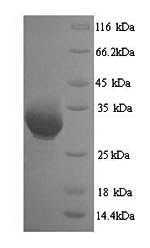 Recombinant Human Heterogeneous nuclear ribonucleoproteins A2/B1 (HNRNPA2B1)