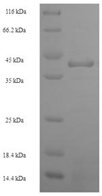 Recombinant Human Heterogeneous nuclear ribonucleoprotein L (HNRNPL), partial