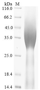 Recombinant Human Homeobox protein Hox-A3 (HOXA3)