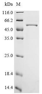 Recombinant Human Heparan-sulfate 6-O-sulfotransferase 1 (HS6ST1), partial, Homo sapiens (Human), E.coli, C-terminal 6xHis-tagged, 51.0kDa, purity >85% as determined by SDS-PAGE.