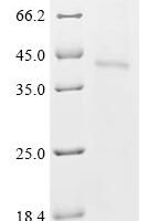 (Tris-Glycine gel) Discontinuous SDS-PAGE (reduced) with 5% enrichment gel and 15% separation gel.
