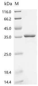Recombinant Human 3 beta-hydroxysteroid dehydrogenase/Delta 5-->4-isomerase type 2 (HSD3B2), partial