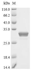 Recombinant Human Basement membrane-specific heparan sulfate proteoglycan core protein (HSPG2), partial, Homo sapiens (Human), E.coli, C-terminal 6xHis-tagged, 27.5kDa, purity >85% as determined by SDS-PAGE.