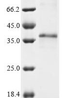 (Tris-Glycine gel) Discontinuous SDS-PAGE (reduced) with 5% enrichment gel and 15% separation gel.