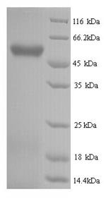 Recombinant Human Hyaluronidase-2 (HYAL2), Homo sapiens (Human), Yeast, N-terminal 6xHis-tagged, 51.3kDa, purity >90% as determined by SDS-PAGE.