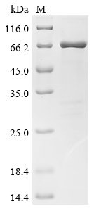 Recombinant Human Islet cell autoantigen 1 (ICA1), Homo sapiens (Human), E.coli, N-terminal 10xHis-tagged and C-terminal Myc-tagged, 62.1kDa, purity >85% as determined by SDS-PAGE.