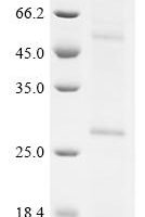 (Tris-Glycine gel) Discontinuous SDS-PAGE (reduced) with 5% enrichment gel and 15% separation gel.