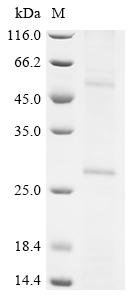 Recombinant Human Putative palmitoyltransferase ZDHHC22 (ZDHHC22) Protein, Homo sapiens (Human), in vitro E.coli expression system, N-terminal 10xHis-tagged, 30.6kDa, purity >85% as determined by SDS-PAGE.