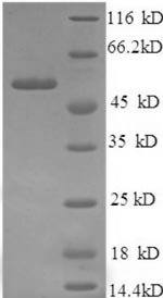 Recombinant Human Islet cell autoantigen 1 (ICA1), partial