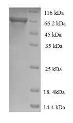 Recombinant Human Alpha-L-iduronidase (IDUA)