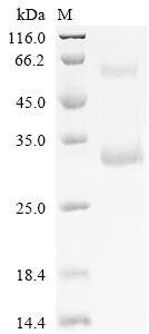 Recombinant Interferon protein SDS-PAGE analysis