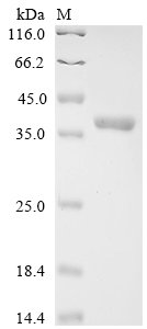 Recombinant Human Interferon-induced 35 kDa protein (IFI35)