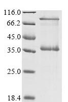 (Tris-Glycine gel) Discontinuous SDS-PAGE (reduced) with 5% enrichment gel and 15% separation gel.