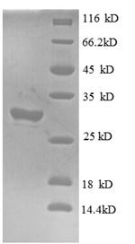 Recombinant Human Interferon-induced transmembrane protein 1 (IFITM1), partial, Homo sapiens (Human), E.coli, N-terminal GST-tagged, 31.0kDa, purity >90% as determined by SDS-PAGE.