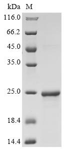 Recombinant Human Interferon alpha-16 (IFNA16)