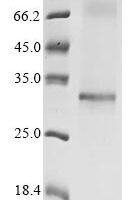 (Tris-Glycine gel) Discontinuous SDS-PAGE (reduced) with 5% enrichment gel and 15% separation gel.