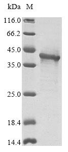 Recombinant Human Interferon kappa (IFNK)