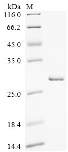 Recombinant Human Interferon kappa (IFNK)