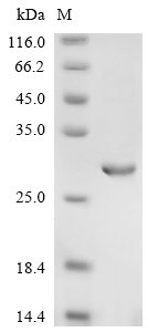 Recombinant Human Interferon lambda receptor 1 (IFNLR1), partial