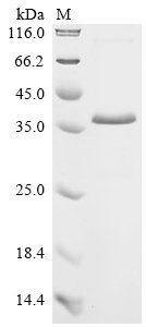 Recombinant Human Insulin-like growth factor-binding protein 7 (IGFBP7)