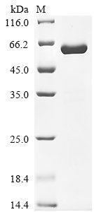 Recombinant Human Insulin-like growth factor-binding protein 7 (IGFBP7) (Active), Homo sapiens (Human), Mammalian cell, C-terminal hFc1-tagged, 55.4kDa, purity >95% as determined by SDS-PAGE.