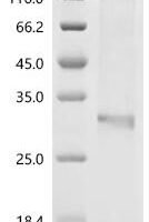 (Tris-Glycine gel) Discontinuous SDS-PAGE (reduced) with 5% enrichment gel and 15% separation gel.