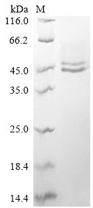 Recombinant Human Interleukin-12 subunit beta (IL12B)