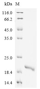Recombinant Human Interleukin-18 (IL18), Homo sapiens (Human), E.coli, C-terminal 6xHis-tagged, 19.0kDa, purity >90% as determined by SDS-PAGE.