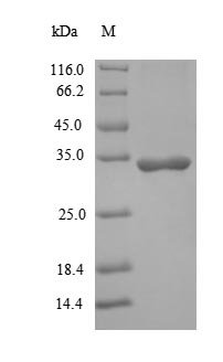 Recombinant Human Interleukin-1 beta (IL1B)