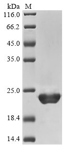 Recombinant Human Interleukin-1 beta protein (IL1B), partial