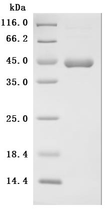 Recombinant Interleukin-2 SDS-PAGE gel analysis
