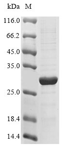 Recombinant Human Interleukin-20 receptor subunit beta (IL20RB), partial