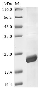 Recombinant Human Interleukin-31 (IL31)
