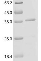 (Tris-Glycine gel) Discontinuous SDS-PAGE (reduced) with 5% enrichment gel and 15% separation gel.