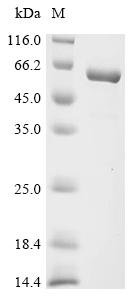 Recombinant Human Inosine-5’-monophosphate dehydrogenase 2 (IMPDH2), partial, Homo sapiens (Human), E.coli, C-terminal 6xHis-tagged, 62.2kDa, purity >90% as determined by SDS-PAGE.