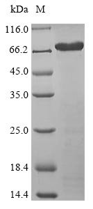 Recombinant Human Isthmin-1 (ISM1)